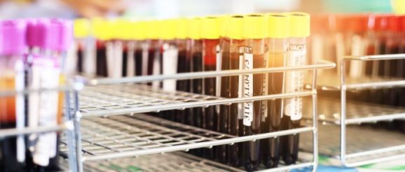 Blood_Lab_Test.jpg