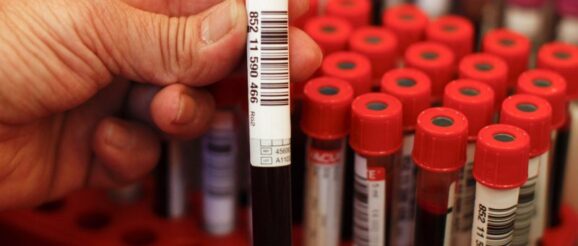 blood-test-2-e1609789318150.jpg